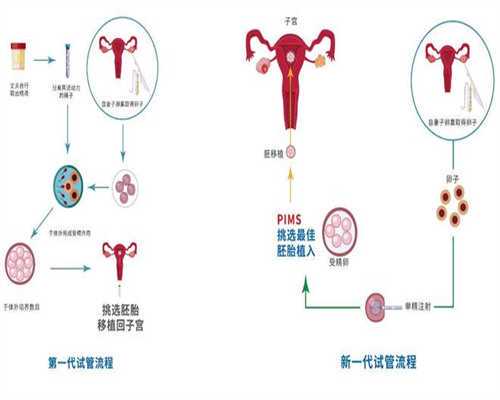 上海试管婴儿中介机构排名榜，位居第一的竟然是它